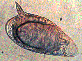 Schistosoma_UK