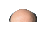 Eu voto no careca!